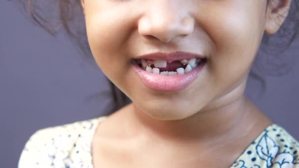 Παιδί κορίτσι χαμογελώντας με παραμορφωμένα δόντια — Αρχείο Βίντεο