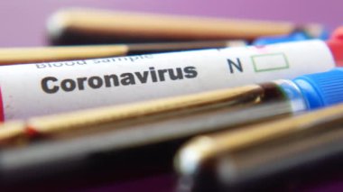 Masadaki Corona virüsünün kan test tüpünü kapatın. 