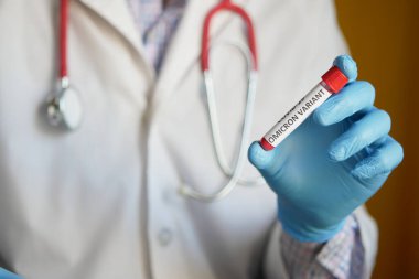  Omikron varyant korona virüsü kan testi tüpü. 