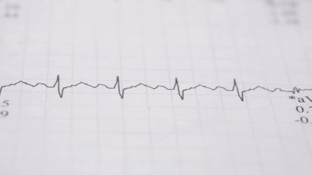 Detalhe tiro de diagrama cardio — Vídeo de Stock