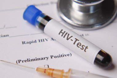 HIV kan testi tüpü ve reçete masada. 