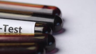 HIV kan testi tüpü ve reçete masada. 