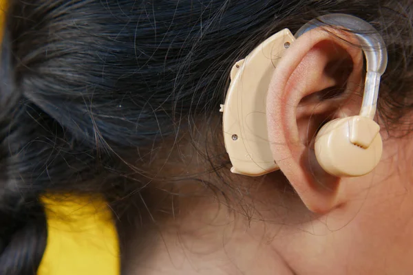Concept d'aide auditive, un enfant ayant des problèmes auditifs. — Photo