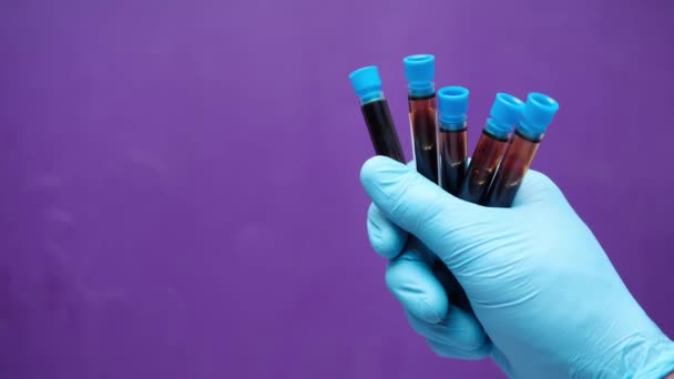 Руки в синих медицинских перчатках с пробиркой для анализа крови — стоковое видео