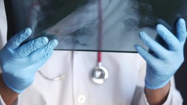 Doktor beklemede. Röntgen fotoğrafçılığı analiz ediliyor. Yakın plan.