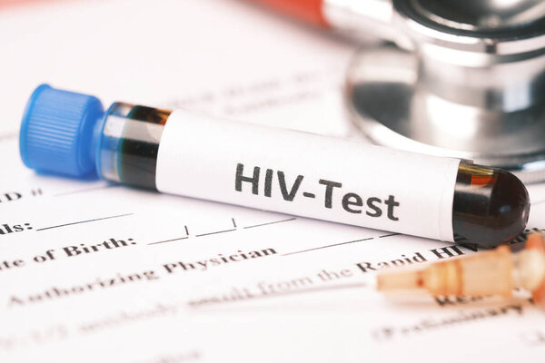 HIV blood test tube and prescription on table 