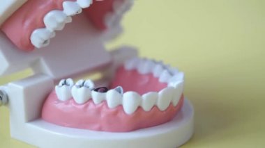  Beyaz arka planda plastik diş modeli 