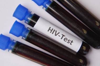 HIV kan testi tüpü ve reçete masada. 
