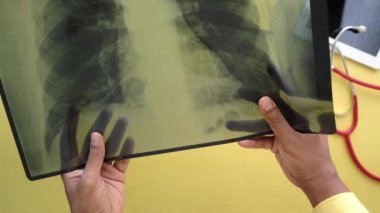 Doktor beklemede. Röntgen fotoğrafçılığı analiz ediliyor. Yakın plan.