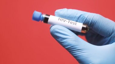  hand in latex gloves holding HIV blood test tube 