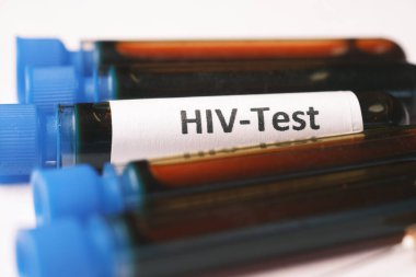 HIV kan testi tüpü ve reçete masada. 