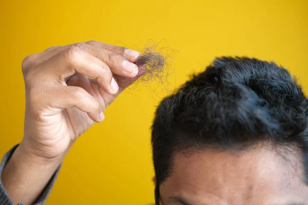 Homem segurar sua lista cabelo perto — Fotografia de Stock