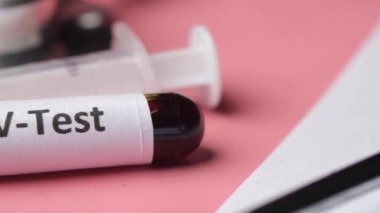 HIV kan testi tüpü ve reçete masada. 