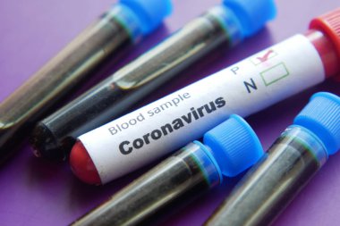 Masadaki Corona virüsünün kan test tüpünü kapatın. 