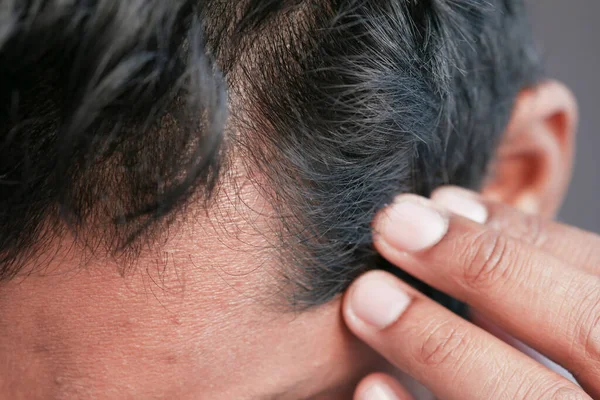 Concepto de pérdida de cabello con el hombre comprobando su cabello — Foto de Stock