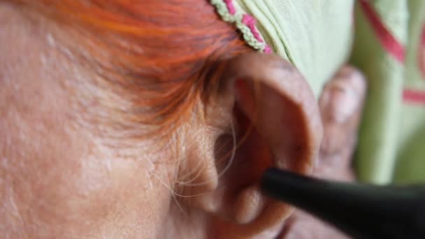 Вивчення вуха пацієнта отоскопом крупним планом — стокове відео