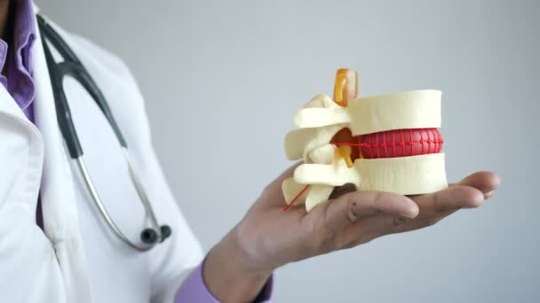 Médico sosteniendo una muestra de médula espinal — Vídeos de Stock