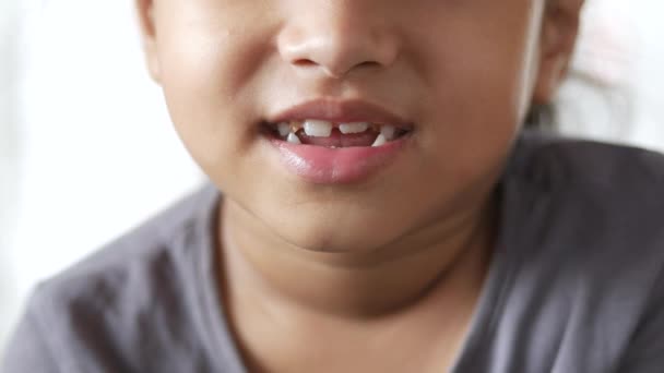 Dziecko dziewczyna uśmiecha się z zdeformowanych zębów — Wideo stockowe