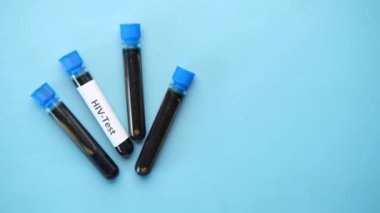 Mavi arka planda HIV kan testi tüpü ve reçetesi 