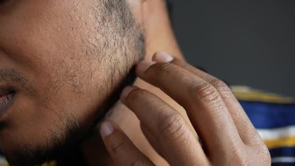 Homme souffrant de démangeaisons cutanées sur son visage — Video