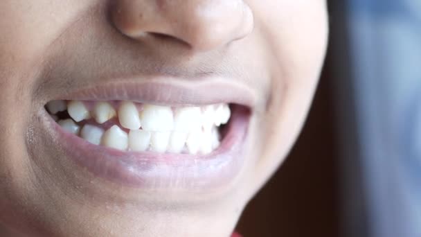 Ragazzo adolescente sorridente con denti bianchi sani. — Video Stock