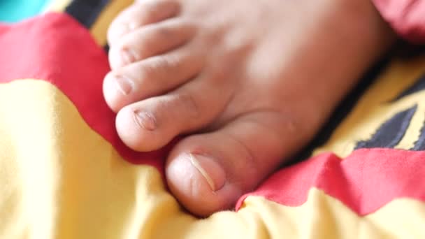 Primer plano de las mujeres pies infectados dedos en la cama , — Vídeos de Stock