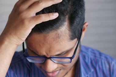 Saç dökülmesi konsepti. 