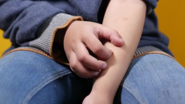 Ребенок девочка страдает зуд кожи на руке — стоковое видео