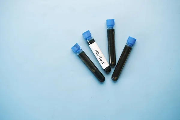 Tubo de teste de sangue HIV e prescrição na mesa — Fotografia de Stock