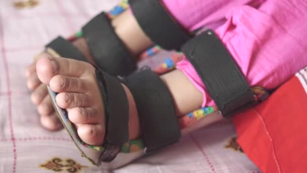 Paralisia Cerebral Infantil Incapacidade Pernas Órtese — Vídeo de Stock