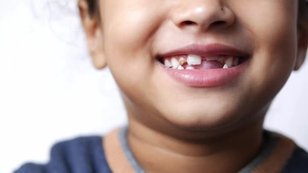 Παιδί Ένα Δόντι Έπεσε Έξω — Αρχείο Βίντεο