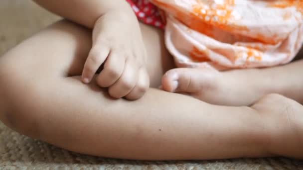 Κορίτσι Παιδί Που Πάσχουν Από Κνησμό Του Δέρματος Κοντινό Πλάνο — Αρχείο Βίντεο