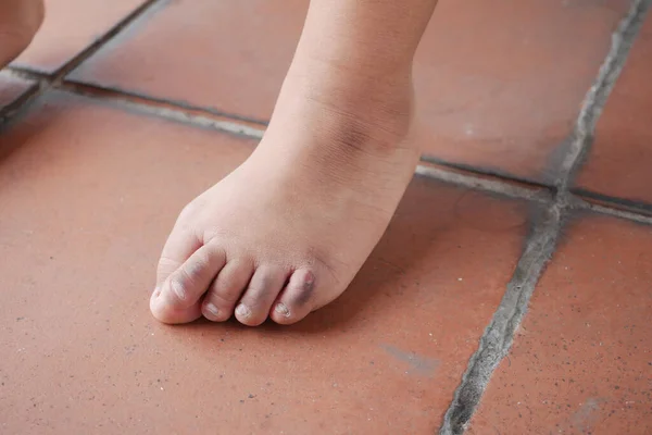 Close Years Old Child Dry Feet Floor —  Fotos de Stock
