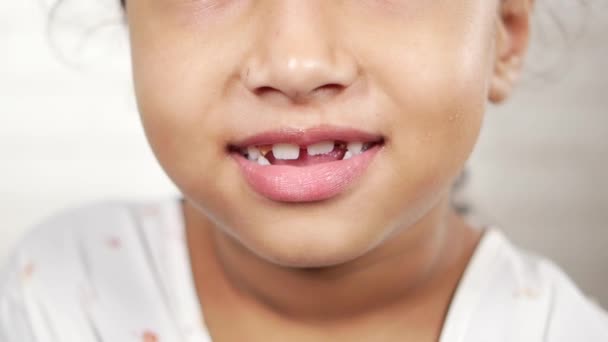 Παιδί Ένα Δόντι Έπεσε Έξω — Αρχείο Βίντεο
