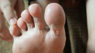 close up of young women dry feet ,