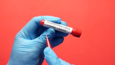 monkeypox text on blood text tube ,