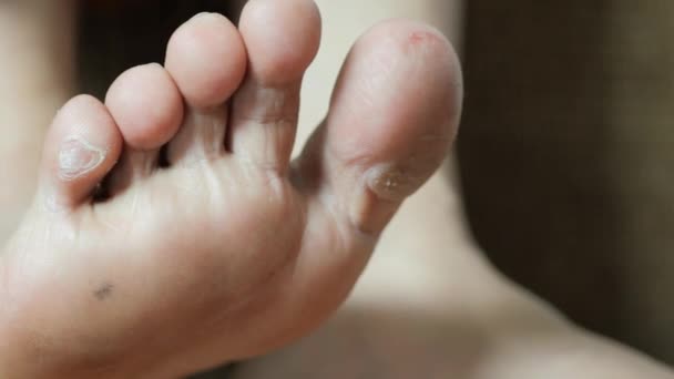 Nahaufnahme Junger Männer Trockene Füße Auf Dem Bett — Stockvideo