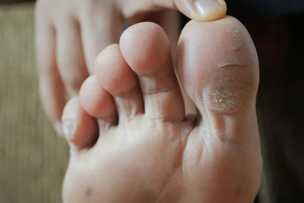 close up of young men dry feet on bed