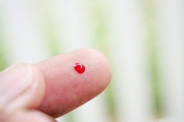 Delikanlılar evlerinde glikoz seviyesini elle ölçerler..