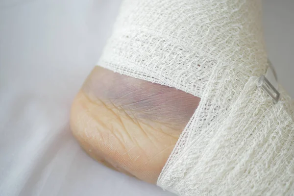 Γυναίκα Δεμένο Πόδι Στο Κρεβάτι — Φωτογραφία Αρχείου