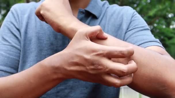Man Suffering Itching Skin Close — Stock Video