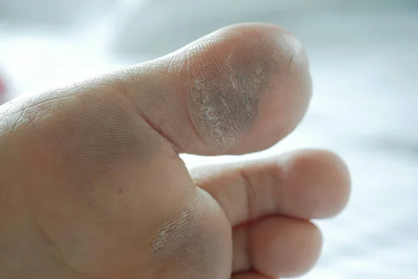 Close Young Men Dry Feet Bed — Stock Photo, Image