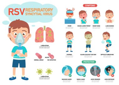RSV Solunum Sistemsel Virüs İnfografik Vektör Çizimi.