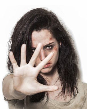 güçlü bir bakışla durdurmak isteyen kız dövülmüş