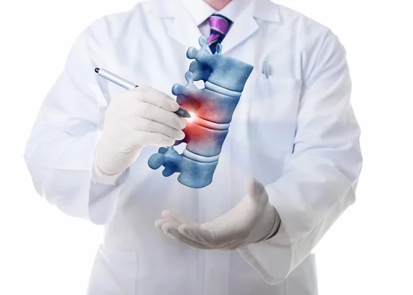 Vertebrae illness — Stock Image Vertebrae illness Stock Photo