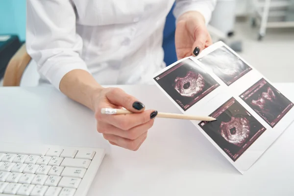 Doktor hastasının ilk üç aylık ultrason görüntülerini gösteriyor. — Stok fotoğraf