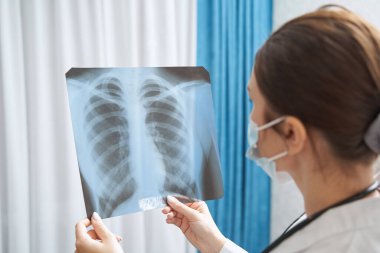 Doktor ellerinde göğüs röntgeni incelemesi yapıyor.