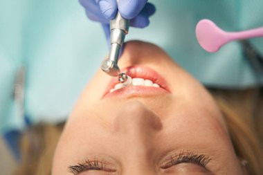Klinikte diş temizleme ve cilalama prosedürü olan bir kadın.