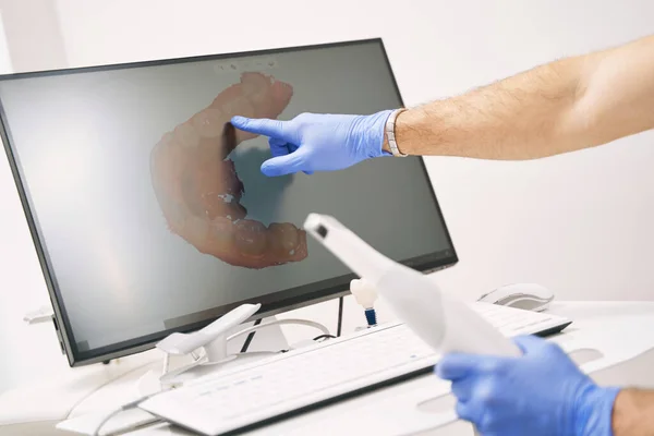 Man tandarts hand wijzend op computer display met tandheelkundige 3D scan — Stockfoto