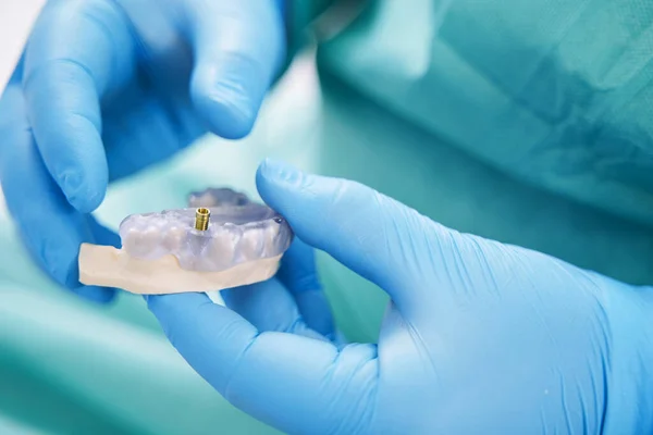 Dentist holding teeth model with metal dental implant — Stock Photo, Image